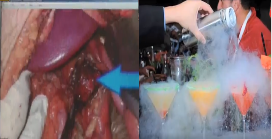 कमजोर दिल वाली दूर रहे:, ये वीडियो जब बीयर बार में युवक ने पी शराब, उसके बाद...