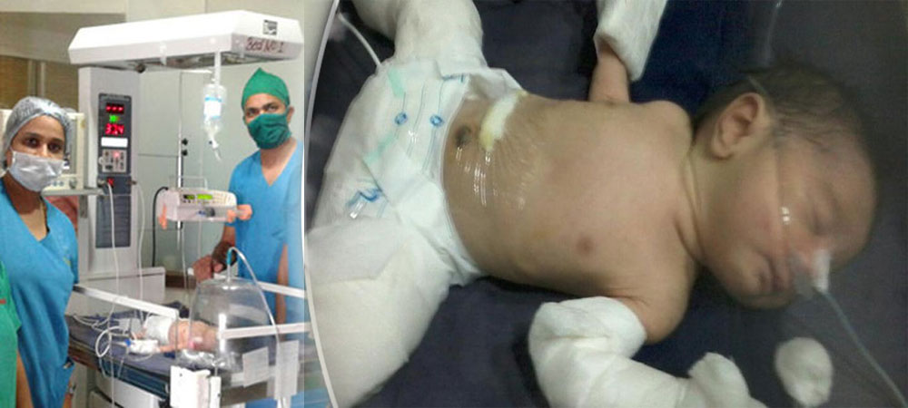 OMG: मुंबई में पैदा हुआ 'प्रेग्नेंट' बच्चा, उसके पेट में पल रहा था उसका ही जुड़वा भाई, डॉक्टर्स भी हुए हैरान...