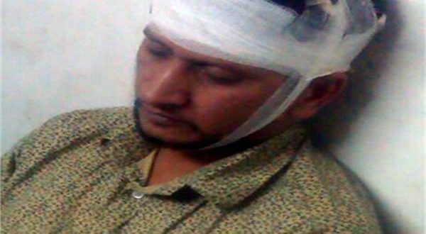 बिहार: शराब माफिया का पत्रकार पर जानलेवा हमला, सिर में आई गंभीर चोटें