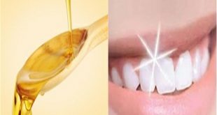 दांत दर्द, पायरिया का रामबाण इलाज है सरसों का तेल, ऐसे करें इस्तेमाल