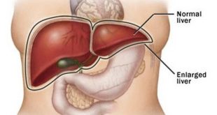 अगर आपके भी शरीर में दिखाई देने लगें ये लक्षण तो समझ जाइये आपका लीवर हो रहा है ख़राब