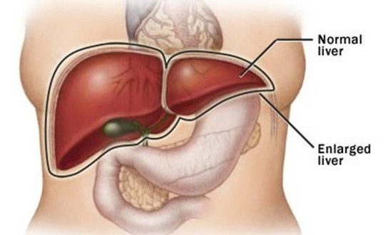अगर आपके भी शरीर में दिखाई देने लगें ये लक्षण तो समझ जाइये आपका लीवर हो रहा है ख़राब