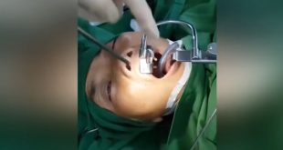 Viral Video : डॉक्टरों को लगा महिला के गले में है ट्यूमर, सर्जरी के दौरान निकली चौंकाने वाली चीज